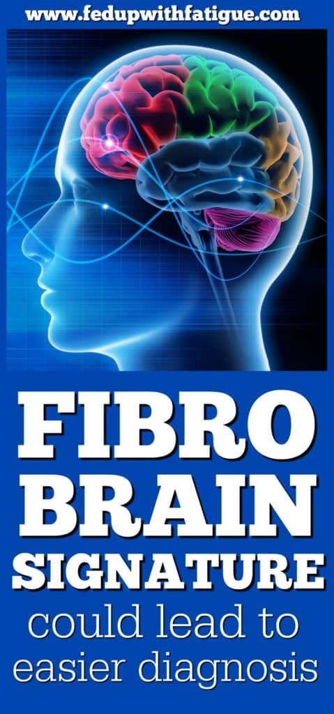 Unique fibromyalgia brain signature could lead to easier diagnosis | University of Colorado Boulder researchers have identified a unique brain signature in fibromyalgia patients. The finding could eventually lead to the development of a diagnostic tool for fibromyalgia. 